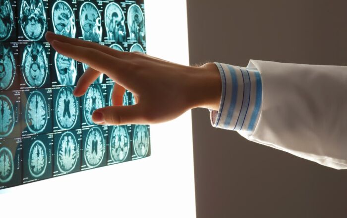 Lesiones Catastróficas with brain scans
